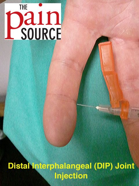 Distal interphalangeal (dip) joint injection