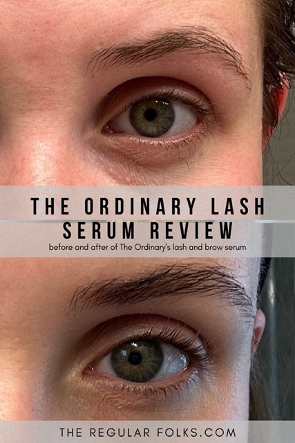 The Ordinary Lash Serum Review (Honest and Unsponsored)