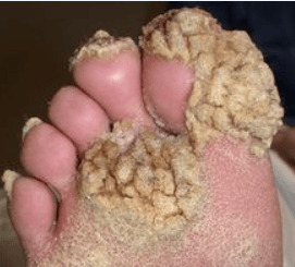 [No Sh*t, Sherlock Dept.] Face-Like-A-Foot Is Going to Get Someone Killed — The Root