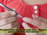 Guide On How To Remove A Splinter In Your Skin