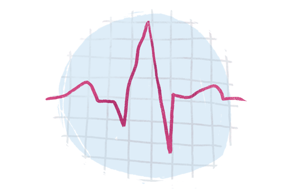 ElectroCardioGram