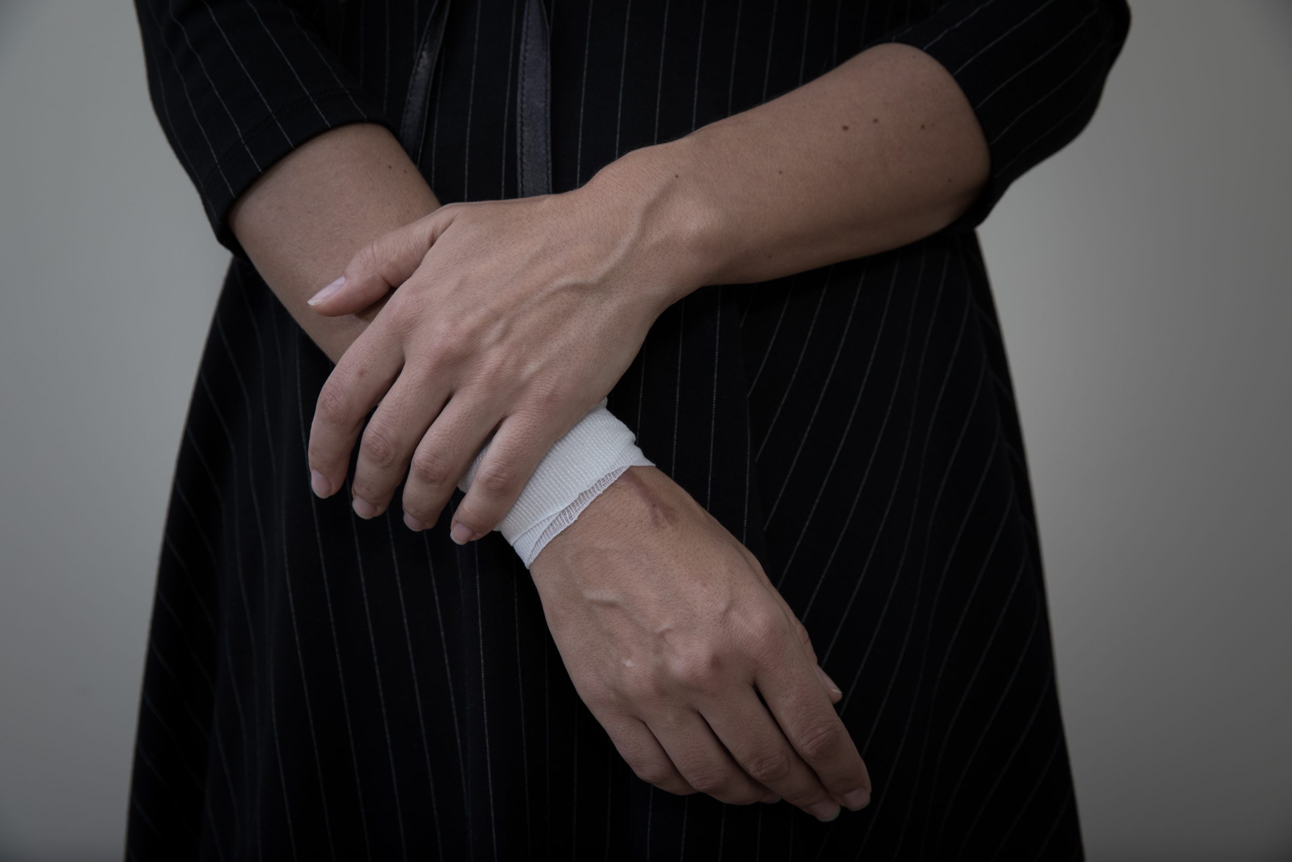 Read more about the article Cutting: A Way to Remind Myself I Was Alive