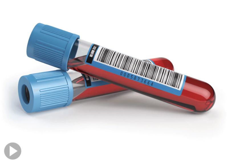 Essential Sample Tracking In Lims - Download Premium Landscape Art | HD