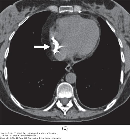 Cardiac Radiography Thoracic Key