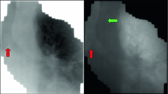 4-Dimensional Imaging for Radiation Oncology: A Clinical Perspective ...