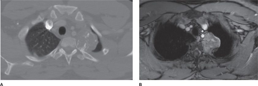Modern Approach to Thoracic Imaging Diagnosis | Thoracic Key