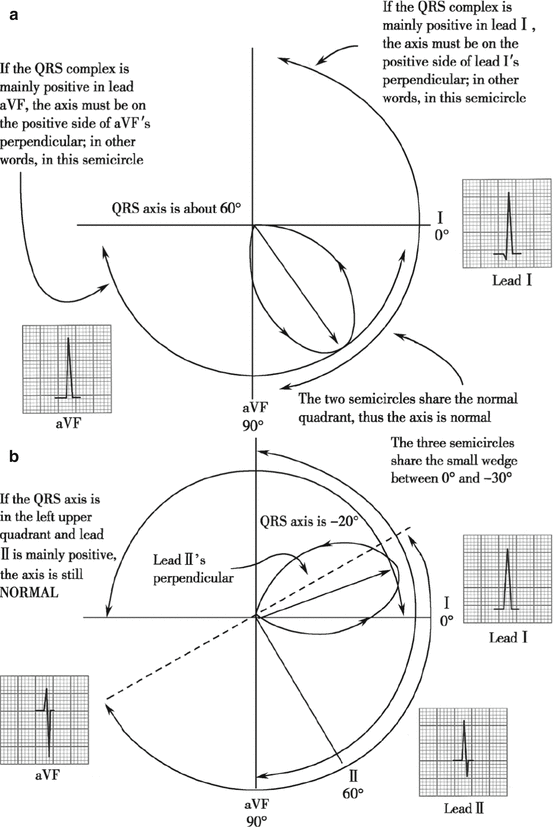 A339142_1_En_4_Fig8_HTML.gif