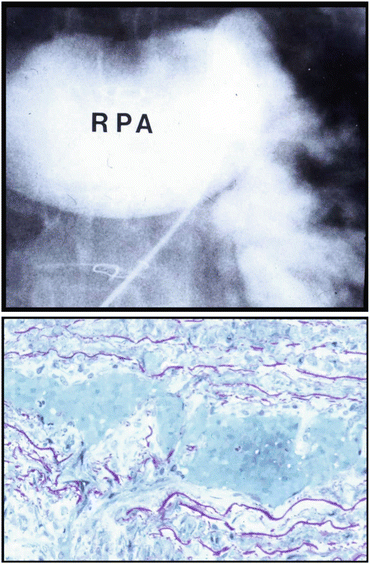 Pathological Background | Thoracic Key