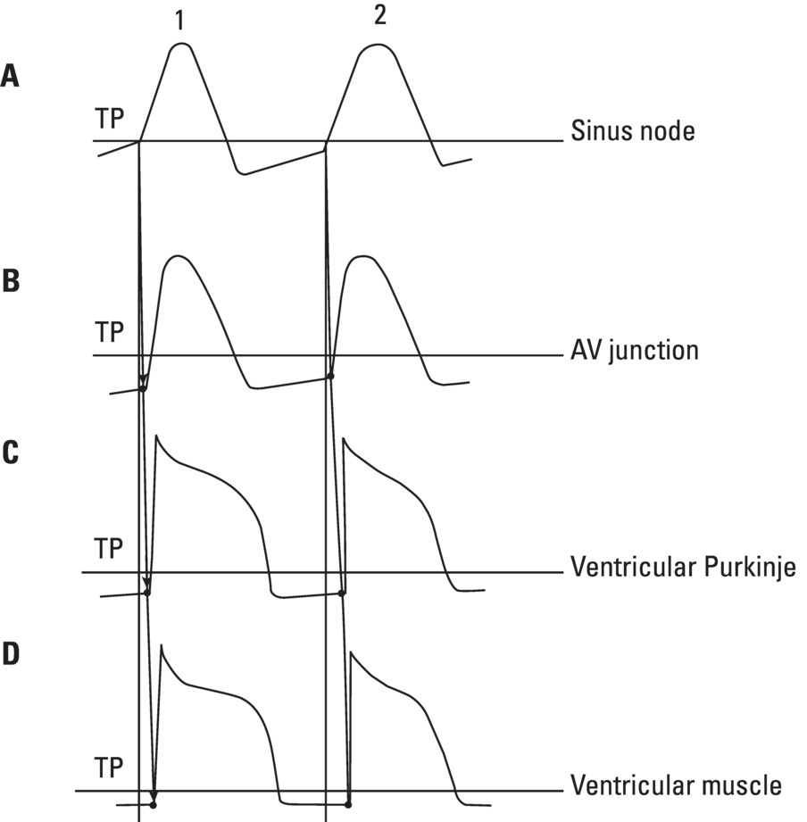 Schematic illustration of the sinus node AP (A) transmitted to the AV junction (B), the ventricular Purkinje (C) and ventricular muscle (D).