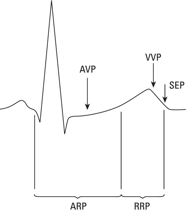 Schematic illustration of the location of refractory periods at AV level, the supernormal excitability phase or period and vulnerable periods at the atrial and ventricular level in the human ECG.