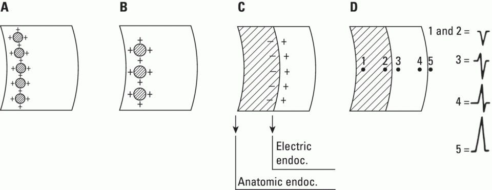 Schematic illustration of the depolarization sequence of the ventricular wall according to the Mexican School.