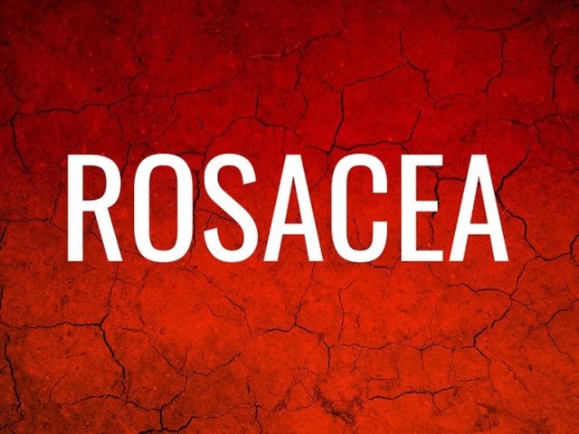 Rosacea