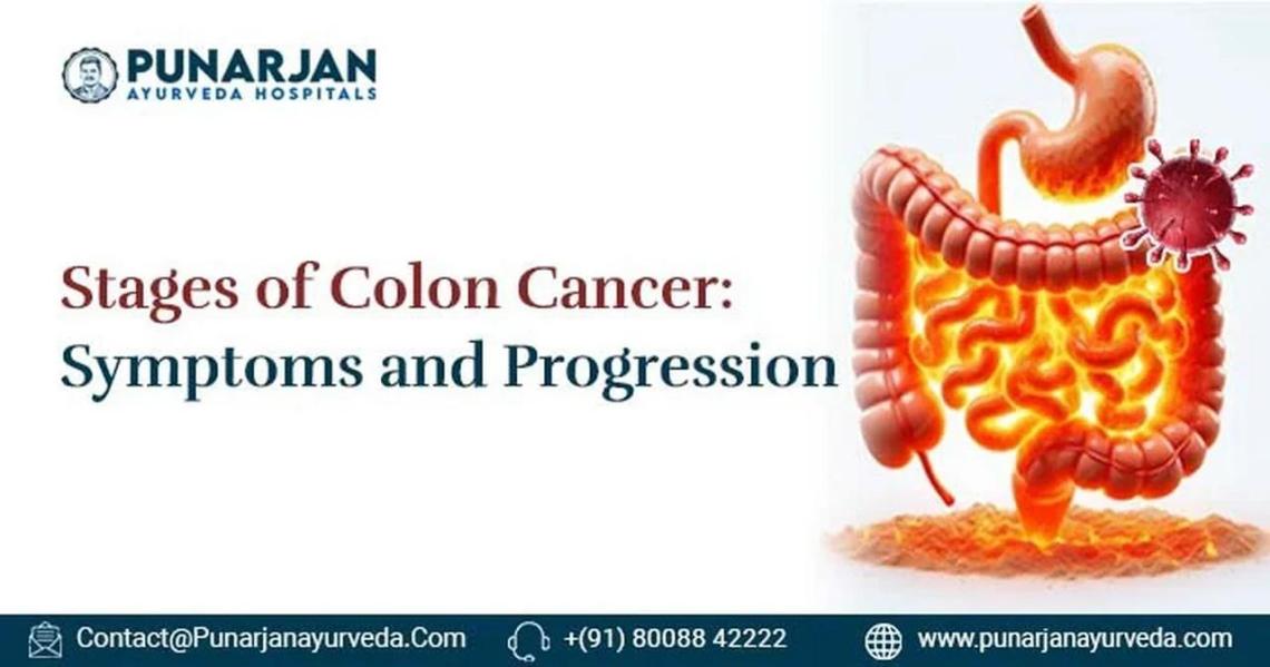 Image Result For Colon Cancer Symptoms Stages Causes And Treatment