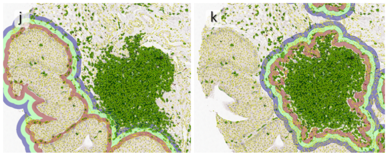 Tma Analysis A Tma Was Generated From Lung Tissue Blocks From - Full HD Ocean Wallpapers for Desktop