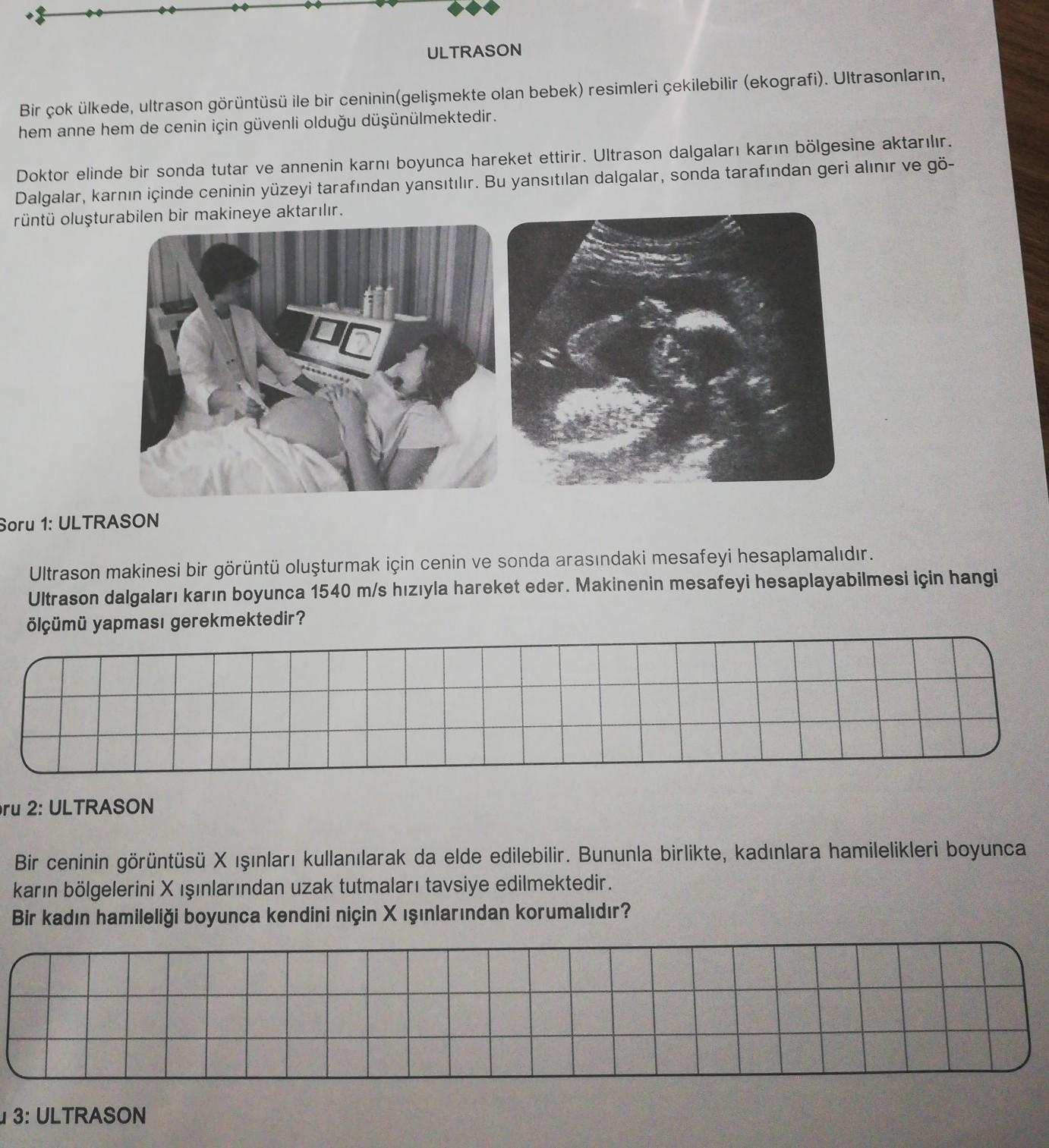 Dapatkan Gambar 9 Haftalik Gebelik Hamilelik Ultrason Goruntuleri Terupdate oleh Lampung Hits