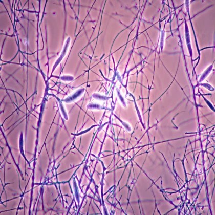 Fungus Microscope NoFilter