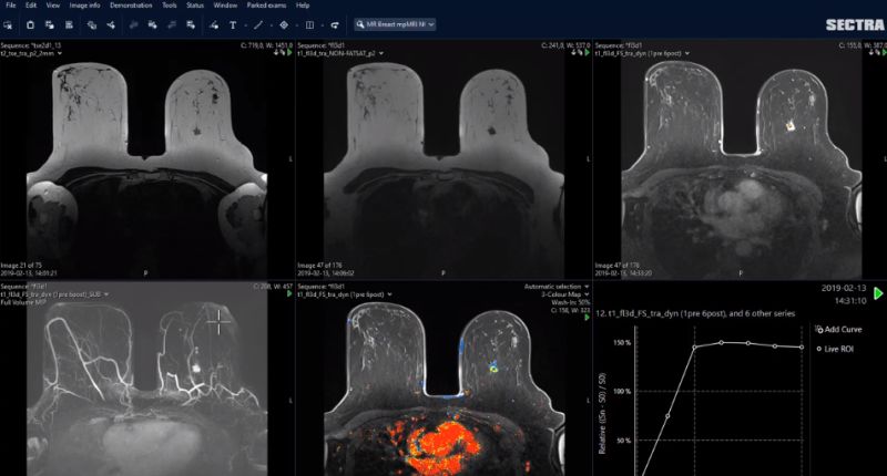 Mp Mri Sectra Global E Learning - Colorful Picture Collection - 4K Quality