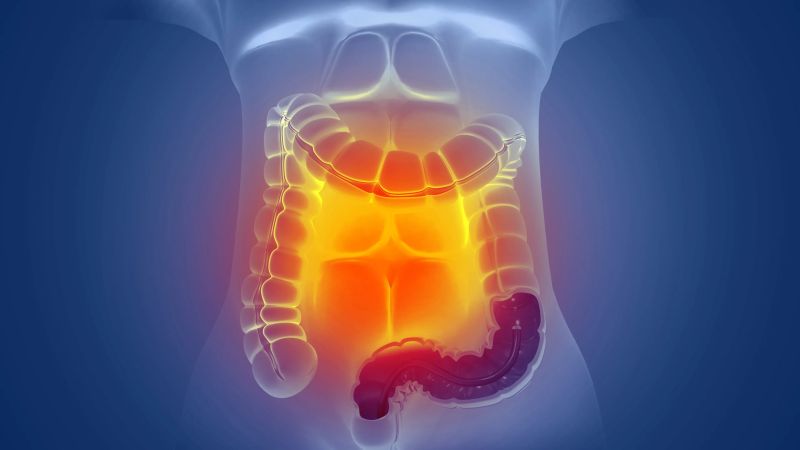 Get A Virtual Colonoscopy With Virtual Imaging Inc - Mobile Vintage Pictures for Desktop