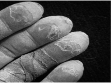 Skin Care for Climbers - Yes Climbing Hand Care is Different Than the Rest! Skin Care for Climbers - Yes Climbing Hand Care is Different Than the Rest!