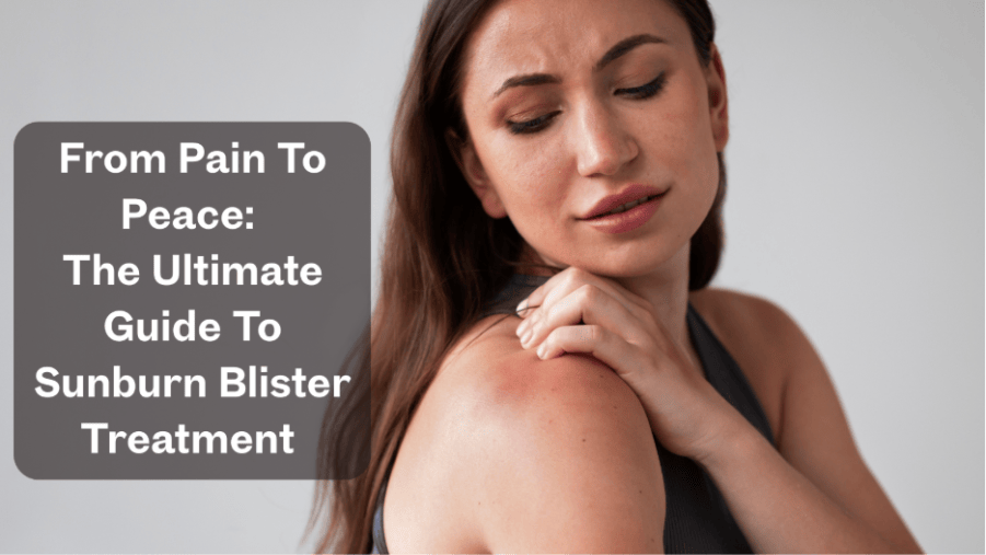 A woman with a painful sunburn on her shoulder, with overlaid text that reads: From Pain To Peace: The Ultimate Guide To Sunburn Blister Treatment.