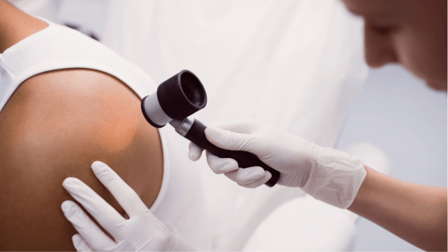 A doctor using a dermatoscope to examine a patient's bare shoulder during a skin check.