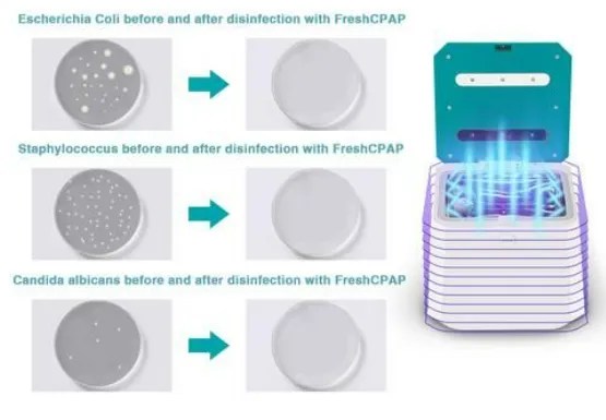 But what about new hires? Oxygo Q8 Fresh Cpap And Device Cleaner Liberty Medical S