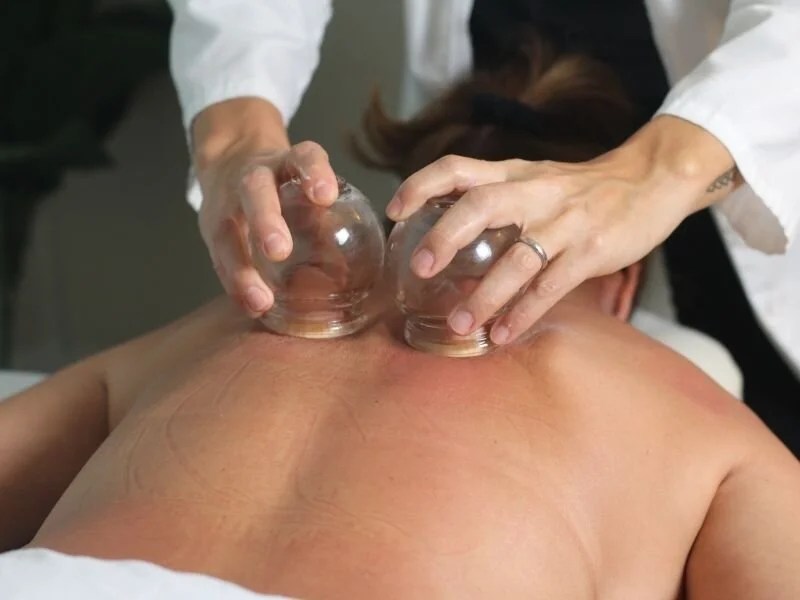 Cupping Therapy in Prosper TX