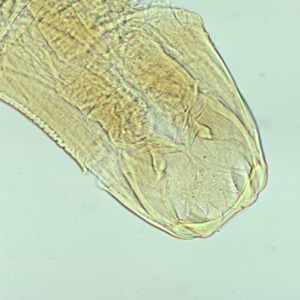 ancylo head