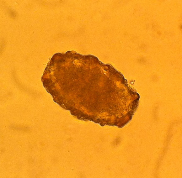 ascaris egg