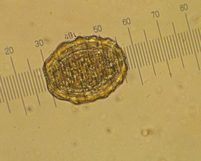 ascaris egg3