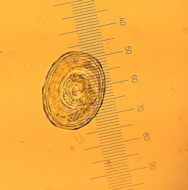ascaris larva