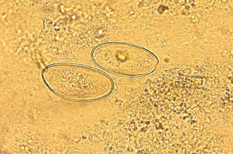 enterobius eggs