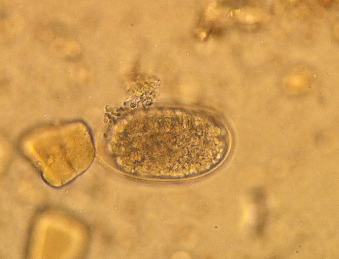 hookworm egg