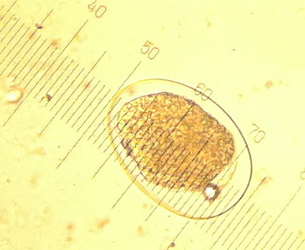 hookworm egg2
