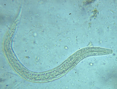 hookworm rhabitiform larvae