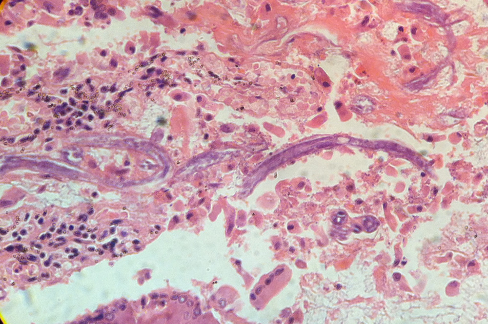 strongy intestinal wall