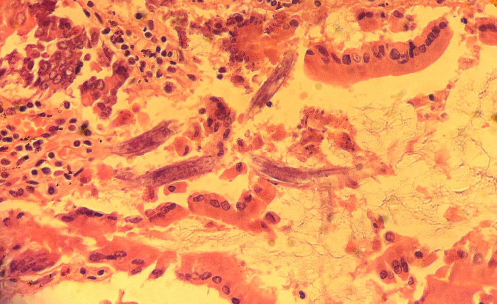 strongy intestinal wall2