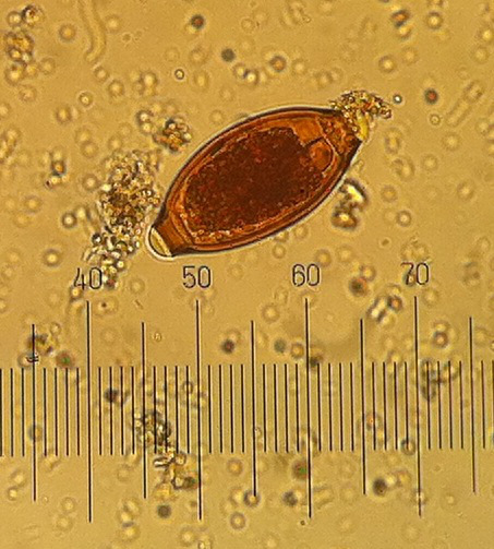 trichuris trichuria egg