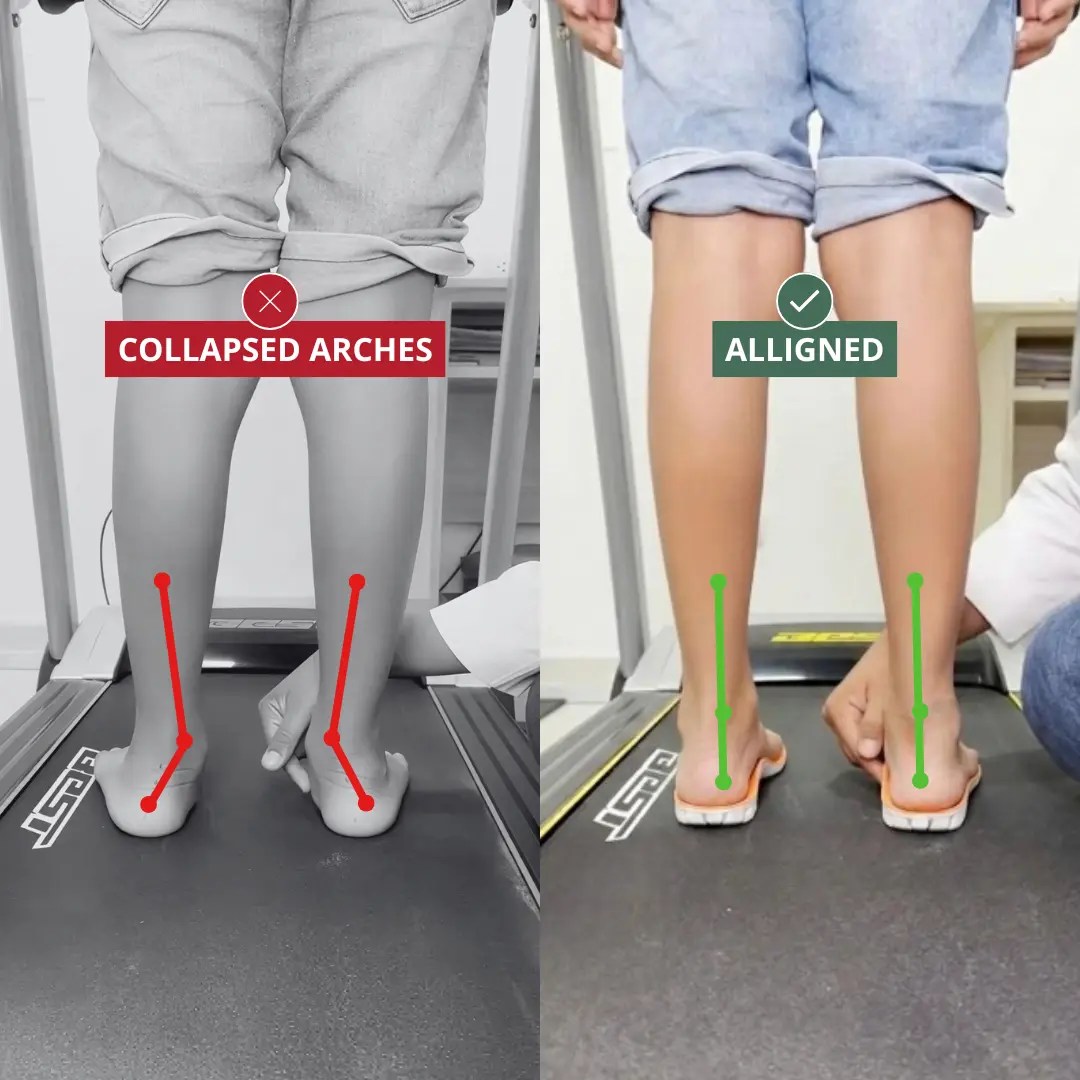 Supports Proper Alignment