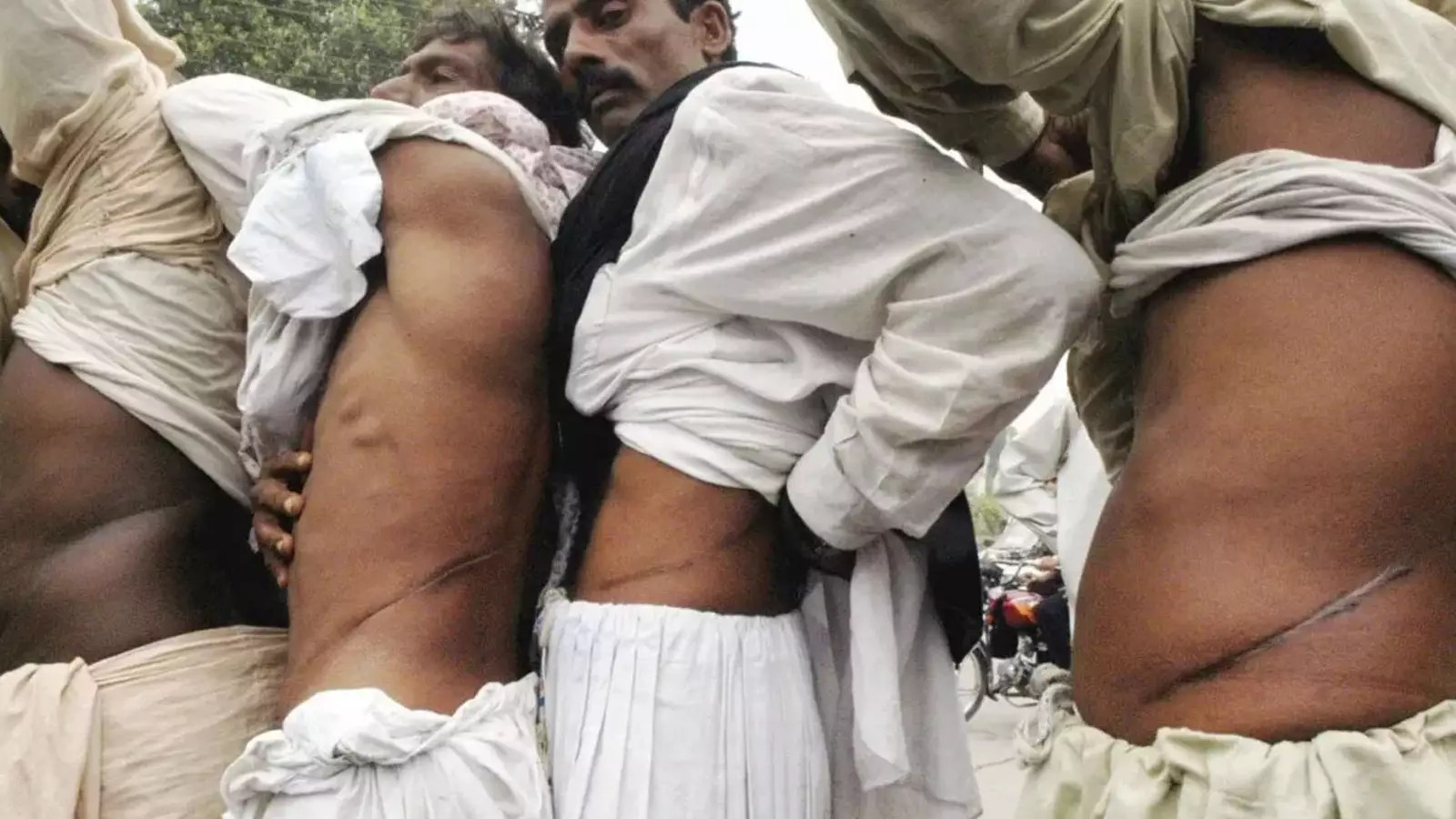 Pakistan’da organ kaçakçılığı yapan çete yakalandı