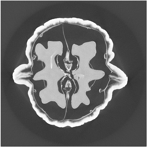 Solution Computed Tomography Terms Studypool - Ultra HD Space Photos for Desktop