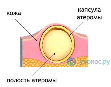 Шишка на мочке за ухом у ребенка. Шишка за ухом у ребенка на кости что это такое. Признаки воспаления шишки за ухом