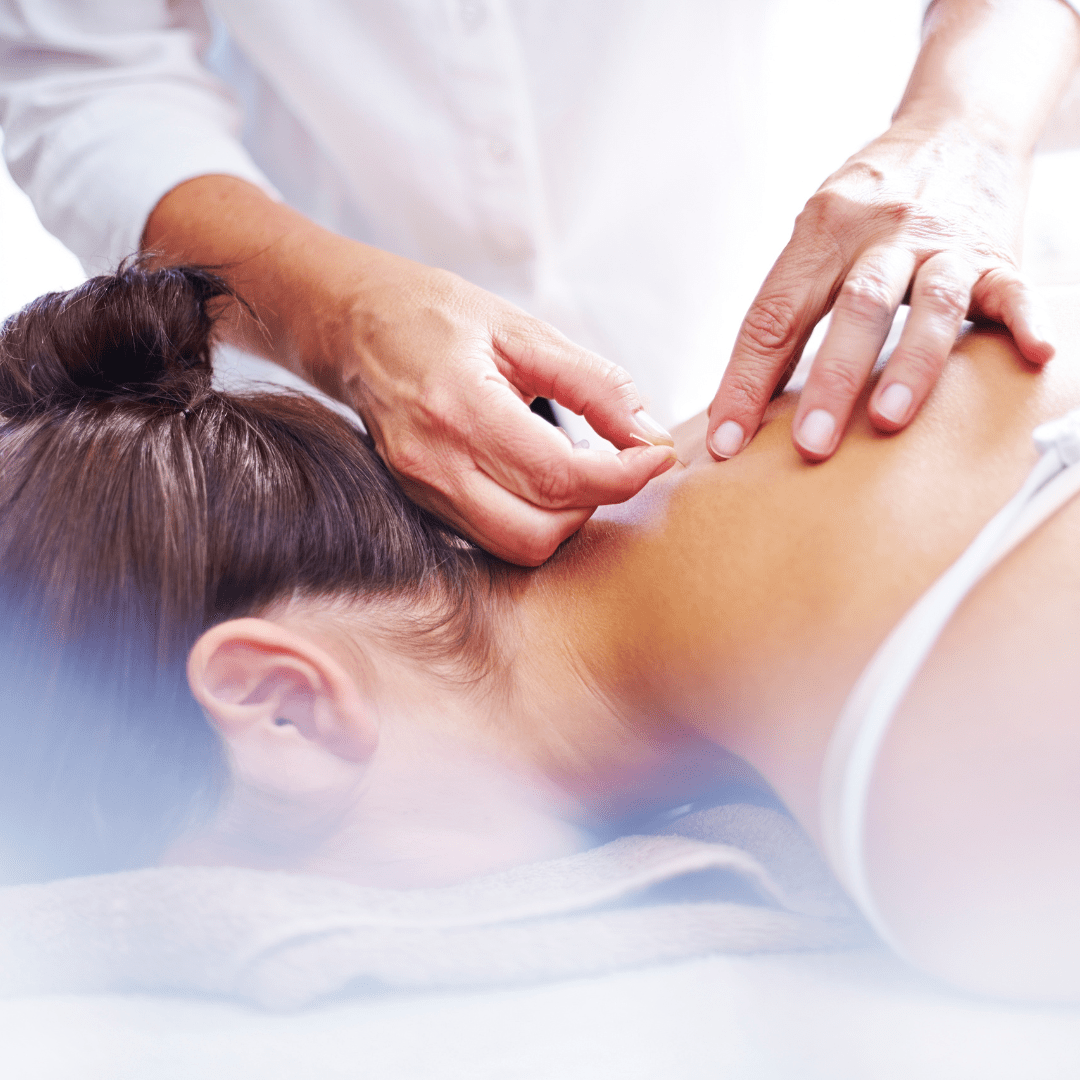 Acupuncture