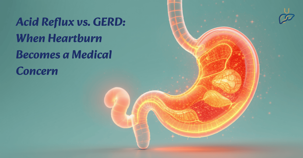 Acid Reflux vs GERD: When Heartburn Becomes a Medical Concern