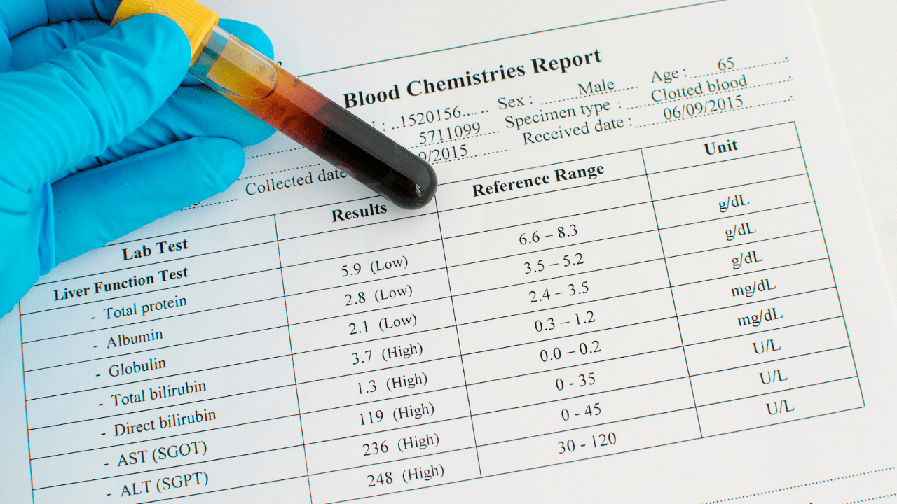 bloodwork: liver function test