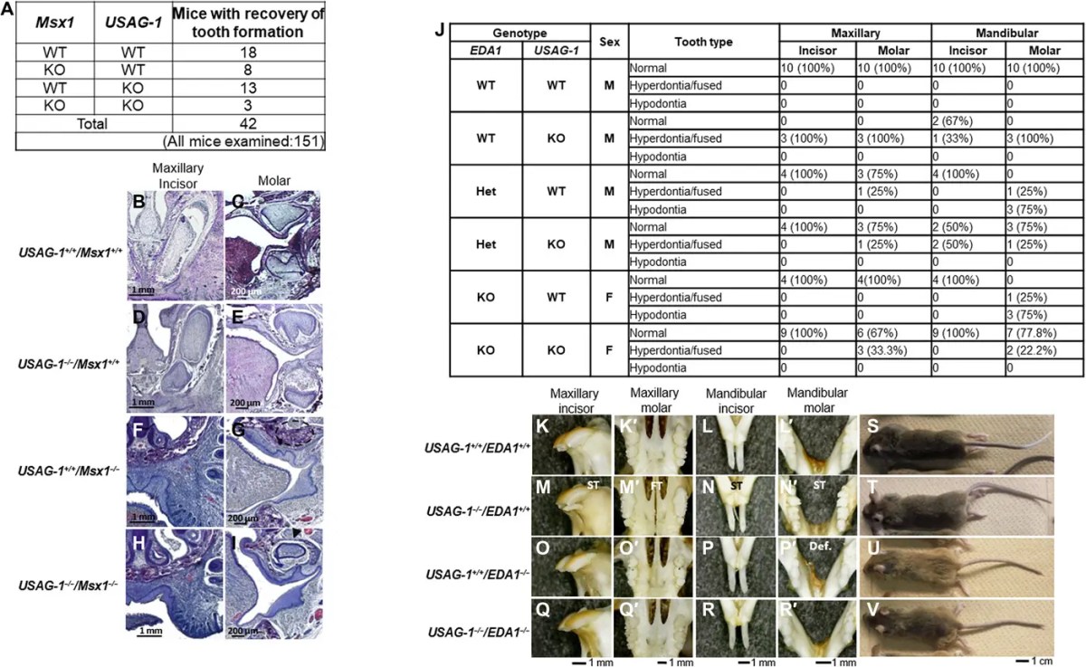 Japan Tests Groundbreaking Drug That Could Grow Teeth in Adults Tooth Development Study