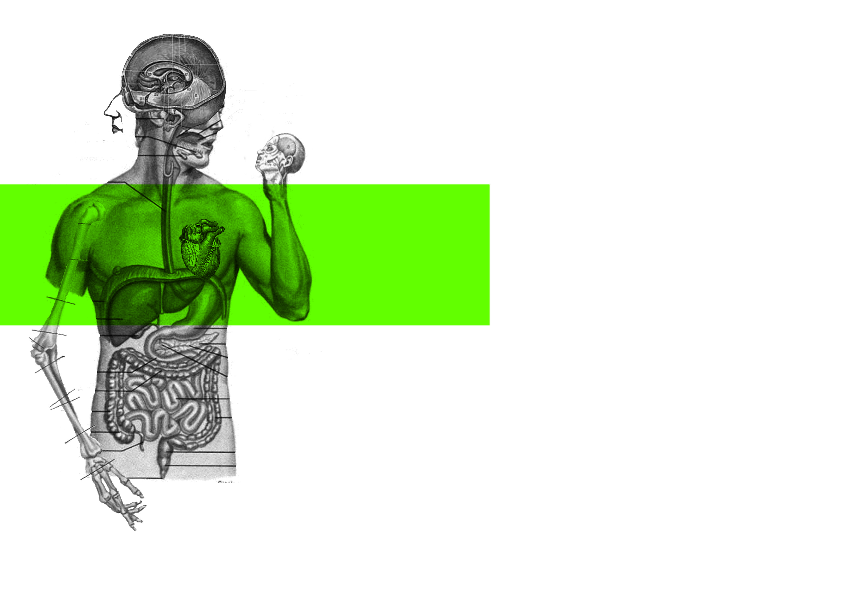 Disection digital collage | Upliftingrefreshment's Blog