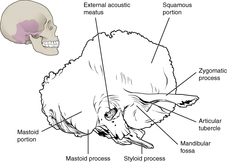 Learn what it is and how to understand the resul. File 708 Temporal Bone Jpg Wikimedia Commons