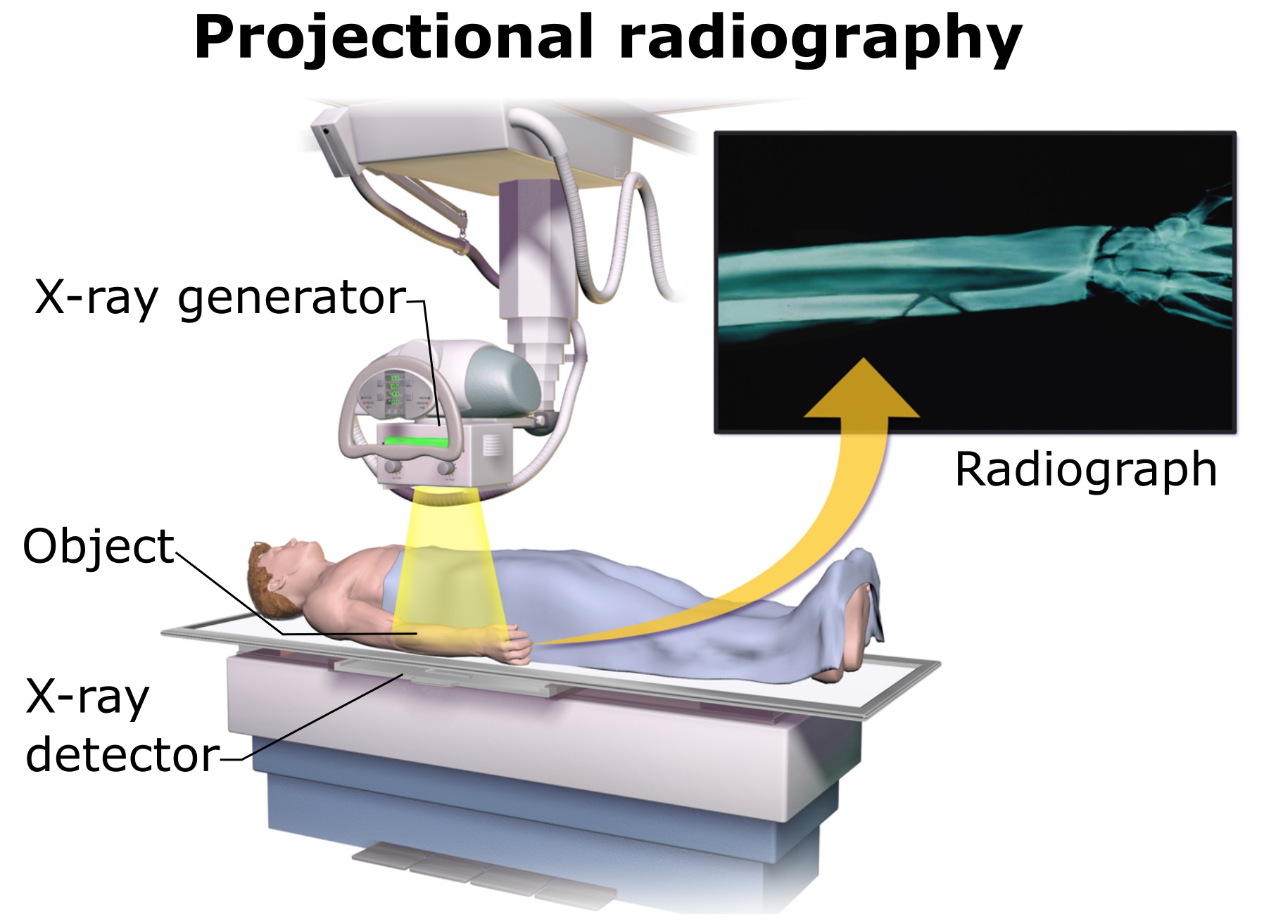 X Ray Detector Wikipedia