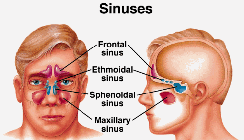 Cara Menyembuhkan Penyakit Sinusitis Secara Alami Tanpa Efek